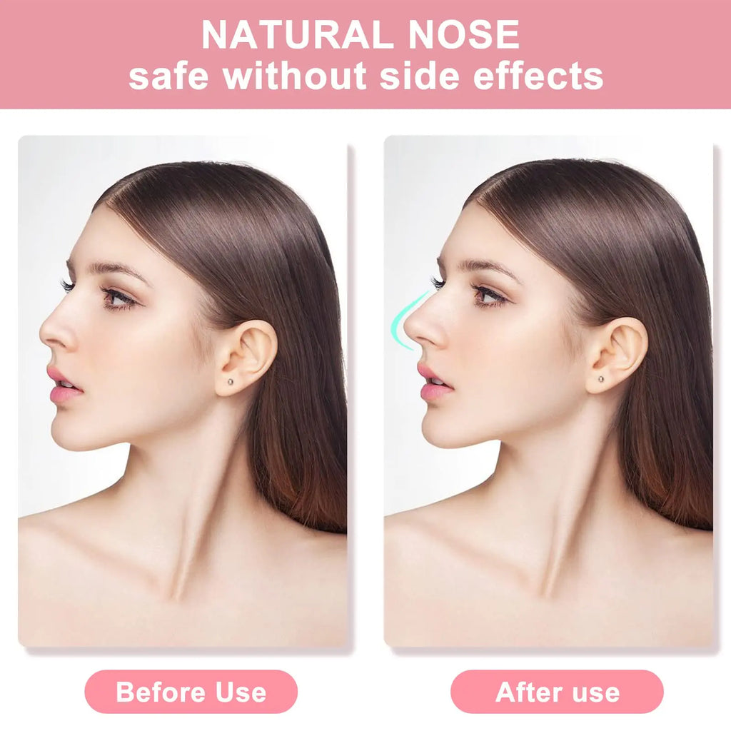 Nose Lifter Beauty Tool Set